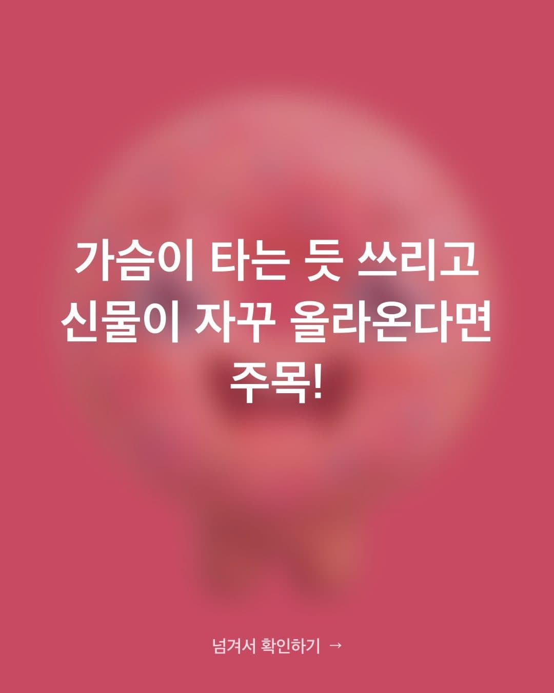 가슴이 타는 듯 쓰리고 신물이 올라온다면 — 역류성 식도염 부르는 음식 3가지